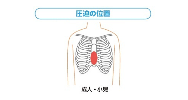 圧迫の位置